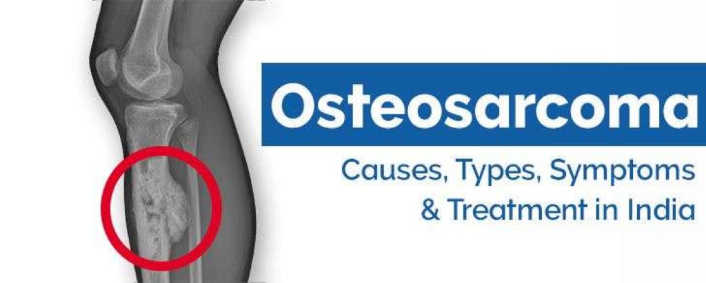 Health Insurance For Osteosarcoma
